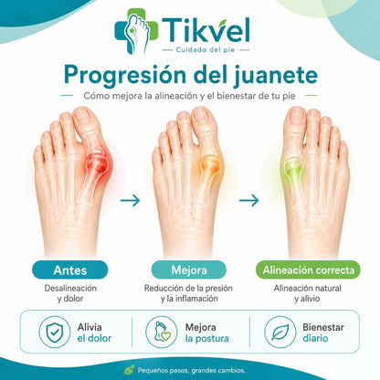 Solución para Juanetes ComfortFix